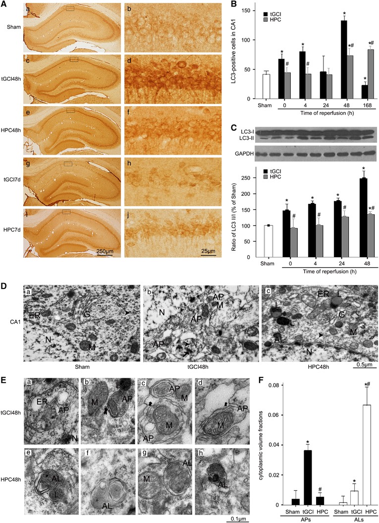 Autophagosome maturation mediated by Rab7 contributes to neuroprotection of  hypoxic preconditioning against global cerebral ischemia in rats | Cell  Death & Disease