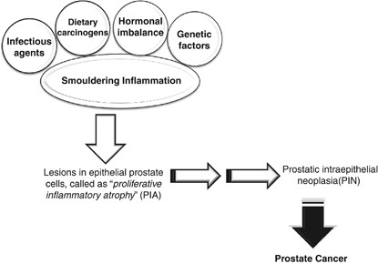 prostate cancer pathophysiology diagram