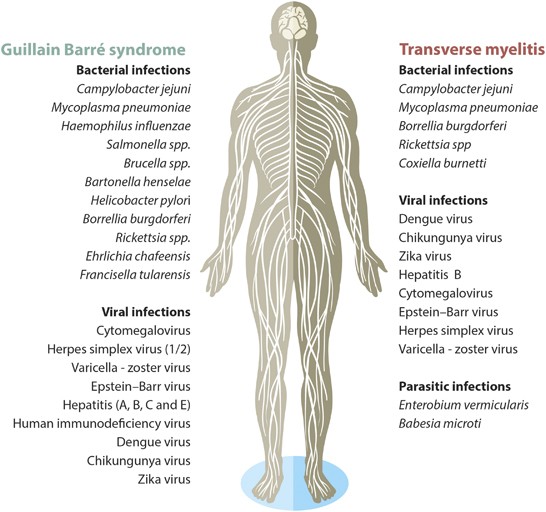 Guillain–Barré syndrome, transverse myelitis and infectious ...