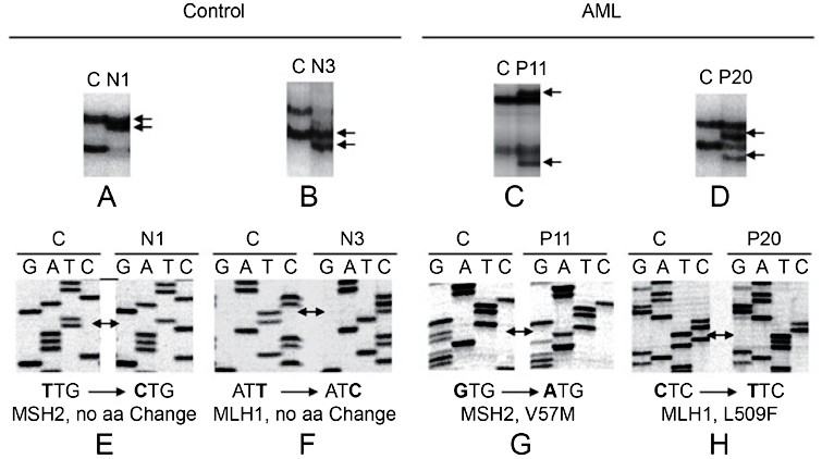 MSP for p15 methylation. Primers were for M sequence respectively