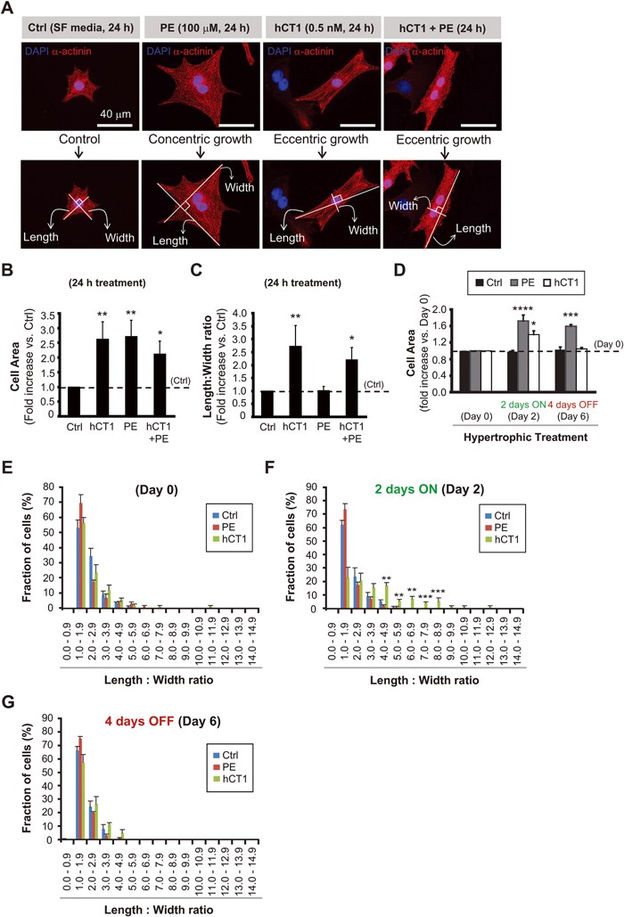 Cardiotrophin 1 Stimulates Beneficial Myogenic And Vascular Remodeling Of The Heart Cell Research