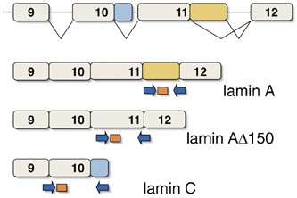 Increased expression of the Hutchinson–Gilford progeria syndrome truncated  lamin A transcript during cell aging | European Journal of Human Genetics