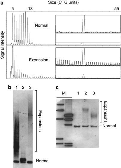 Best Practice Guidelines And Recommendations On The Molecular Diagnosis Of Myotonic Dystrophy Types 1 And 2 European Journal Of Human Genetics