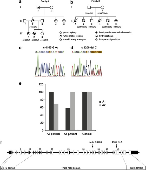 (PDF) Identification of de novo EP300 and PLAU variants in a patient with  Rubinstein–Taybi syndrome-related arterial vasculopathy and skeletal anomaly