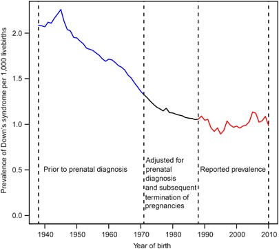 Data and Statistics on Down Syndrome