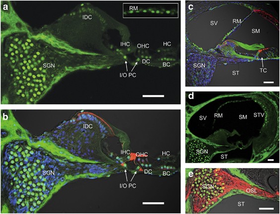 PDF) RNA-Seq analysis of Gtf2ird1 knockout epidermal tissue