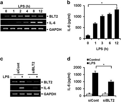 MyD88–BLT2-dependent cascade contributes to LPS-induced interleukin-6  production in mouse macrophage | Experimental & Molecular Medicine