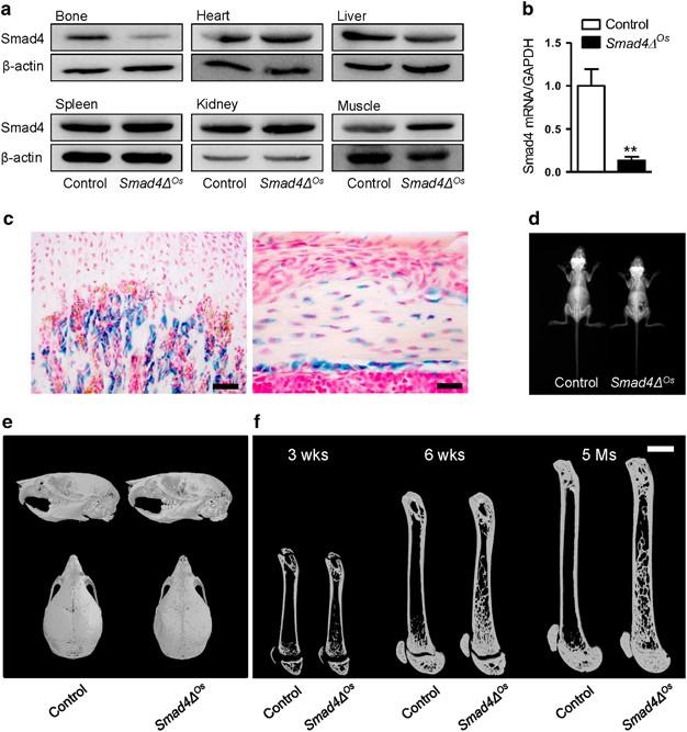 The effects of genetic overexpression of Smad1 within osteoblast on