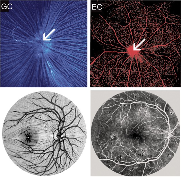 Normal Retinal Anatomy - The Retina Reference