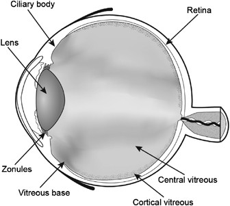 Retinal Detachment NYC - Vitreous Retina Macula Consultants of New