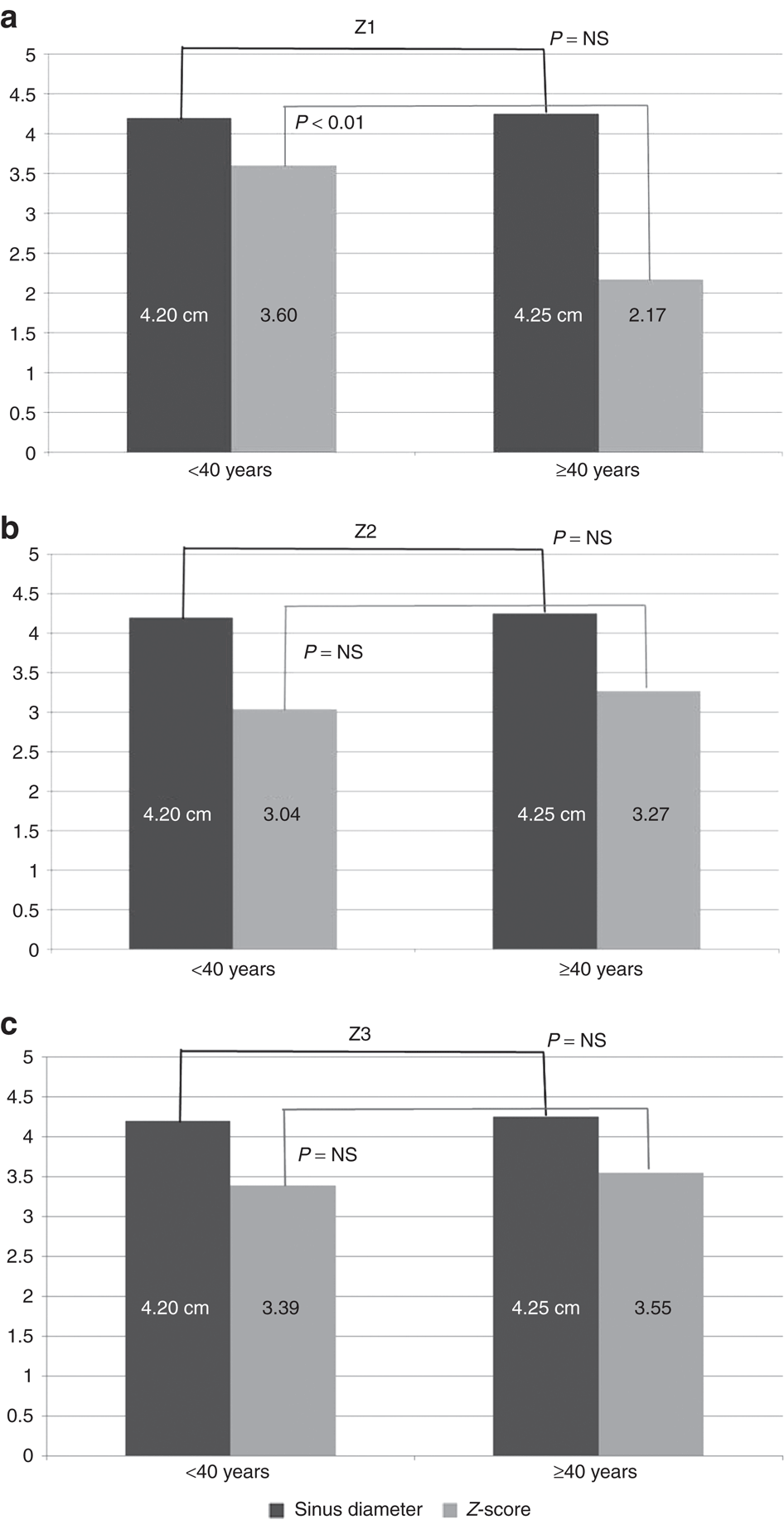 A clinical appraisal of different Z-score equations for aortic root  assessment in the diagnostic evaluation of Marfan syndrome | Genetics in  Medicine