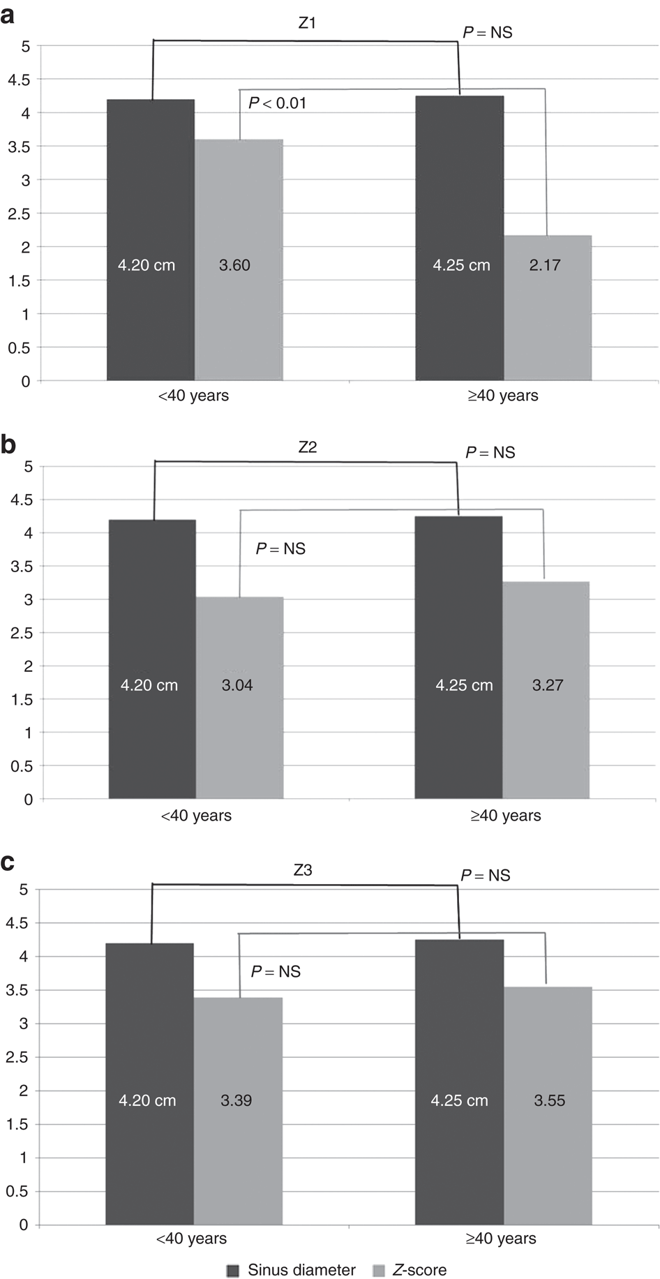 Aortic Root Size Chart