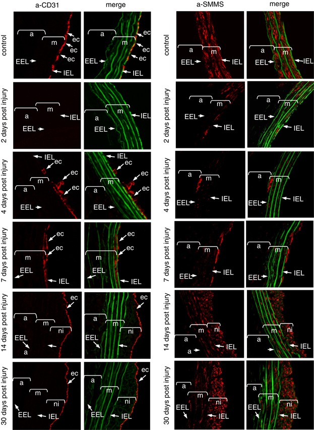 Efficient transduction of vascular smooth muscle cells with a translational  AAV2.5 vector: a new perspective for in-stent restenosis gene therapy |  Gene Therapy