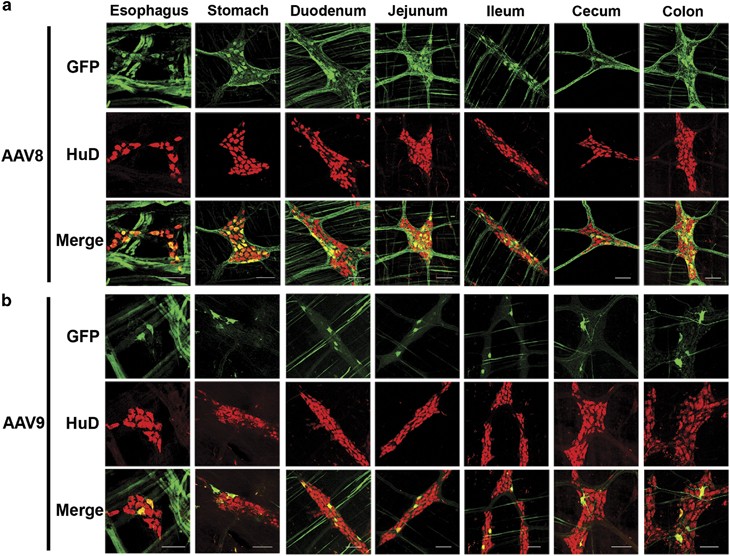 Systemic Gene Delivery Transduces The Enteric Nervous System Of Guinea Pigs And Cynomolgus Macaques Gene Therapy