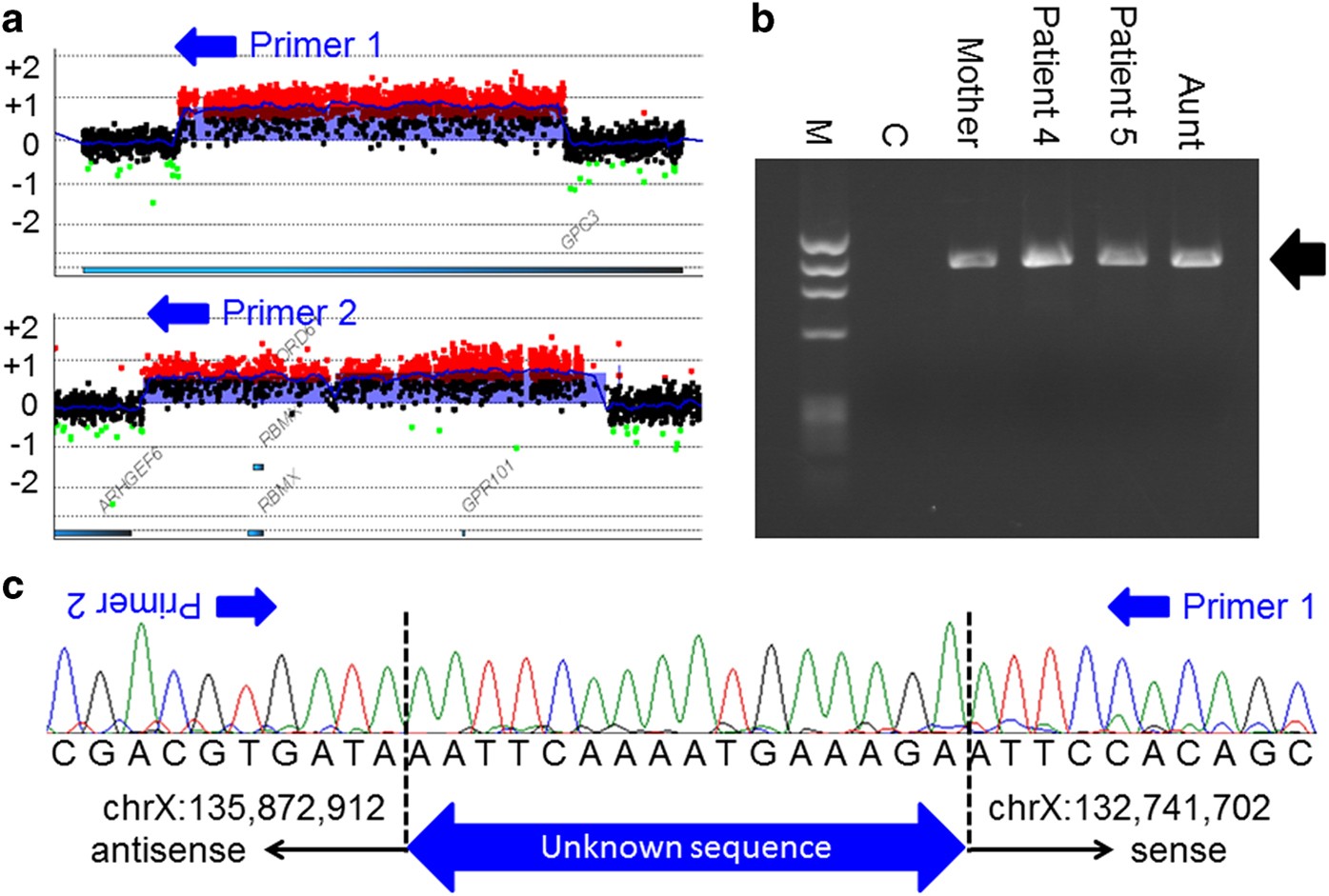 Loss-of-function mutations and global rearrangements in GPC3 in patients  with Simpson–Golabi–Behmel syndrome | Human Genome Variation
