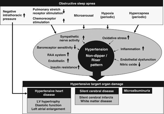 Obstructive Sleep Apnea Syndrome And Hypertension: Mechanism Of The Linkage  And 24-H Blood Pressure Control | Hypertension Research