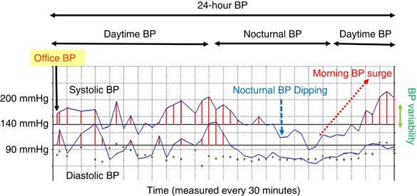 Nocturnal blood pressure and cardiovascular disease: a review of recent  advances | Hypertension Research