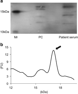 Elevated Vasoinhibin Derived From Prolactin And Cathepsin D Activities In Sera Of Patients With Preeclampsia Hypertension Research Elevated Vasoinhibin Derived From Prolactin And Cathepsin D Activities In Sera Of Patients With Preeclampsia Hypertension Research
