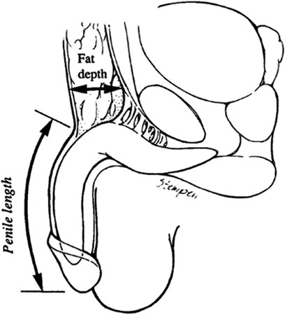 Grow penis fastest way to your How to