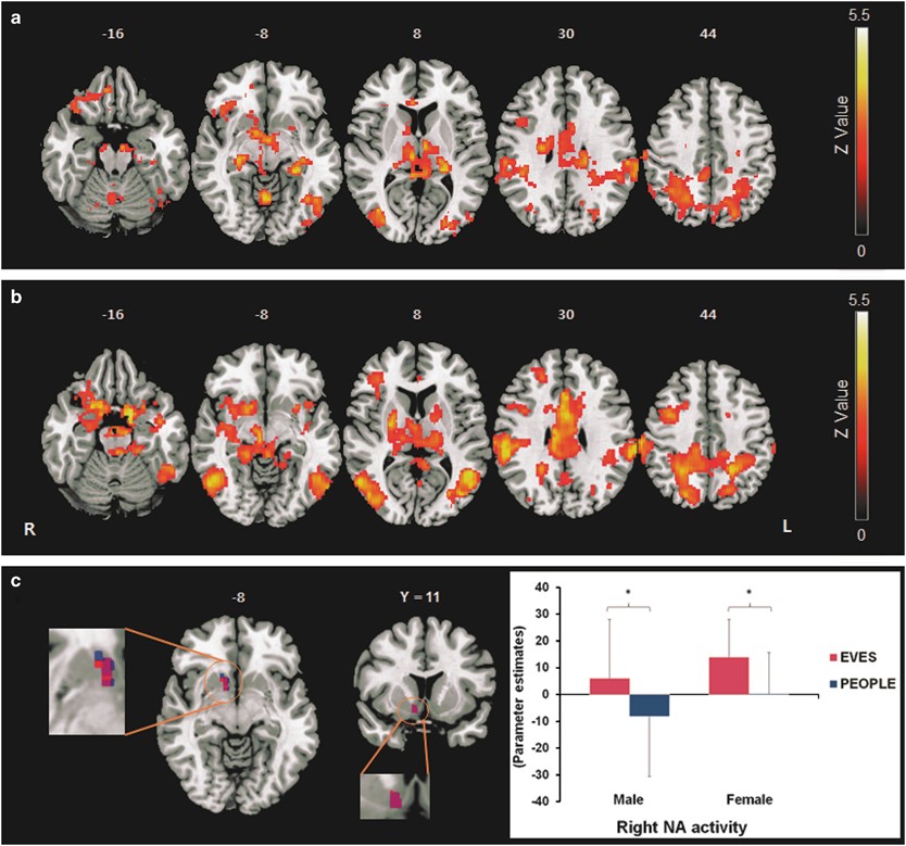 Sex Differences In Interactions Between Nucleus Accumbens - 