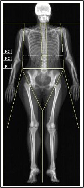 Association of objectively assessed physical activity with total and  central body fat in Spanish adolescents; The HELENA Study | International  Journal of Obesity