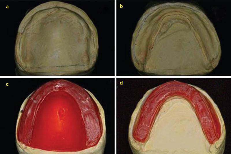 Accuracy Evaluation Of A New Three Dimensional Reproduction - 