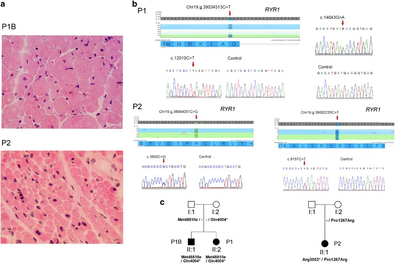 New Massive Parallel Sequencing Approach Improves The - 