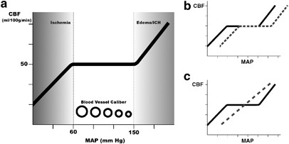 Blood Pressure Management In Acute Stroke Journal Of Human Hypertension