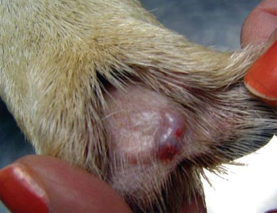 interdigital furuncle treatment