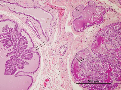 Diagnosis | Cystic mammary gland hyperplasia and neoplasia | Lab Animal Diagnosis | Cystic mammary gland hyperplasia and neoplasia | Lab Animal
