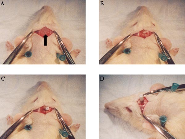 Simplified Surgical Placement and Stabilization Methods for  Intracerebroventricular Cannulas in Rat Lateral Ventricles | Lab Animal