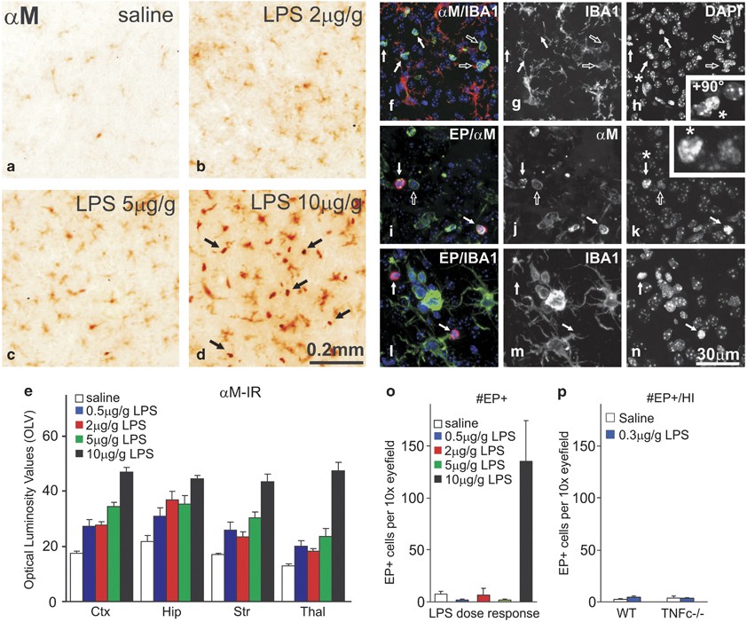 TNF gene cluster deletion abolishes lipopolysaccharide-mediated  sensitization of the neonatal brain to hypoxic ischemic insult | Laboratory  Investigation