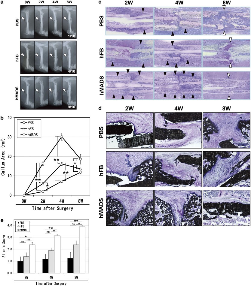 Local transplantation of human multipotent adipose-derived stem cells  accelerates fracture healing via enhanced osteogenesis and angiogenesis |  Laboratory Investigation