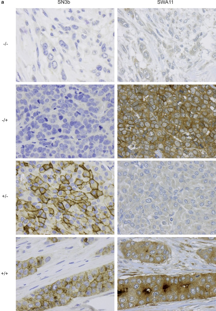 Molecular and clinical dissection of CD24 antibody specificity by a  comprehensive comparative analysis | Laboratory Investigation