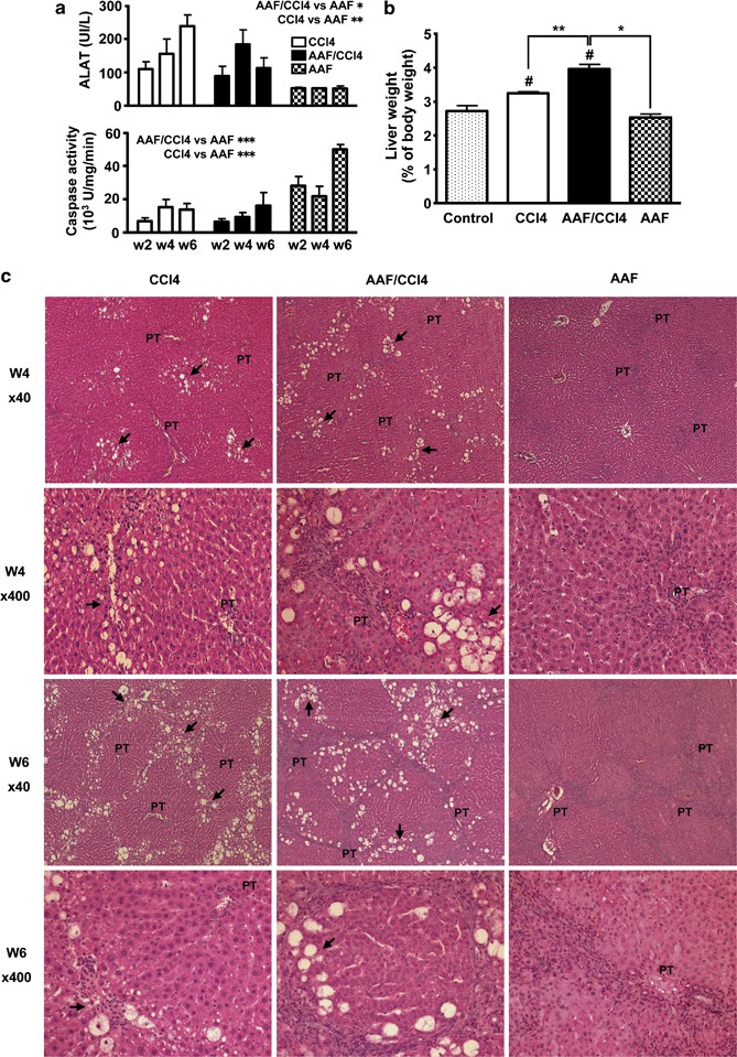 A human multi-lineage hepatic organoid model for liver fibrosis