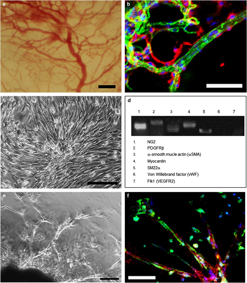 Immortalized multipotent pericytes derived from the vasa vasorum in the  injured vasculature. A cellular tool for studies of vascular remodeling and  regeneration | Laboratory Investigation