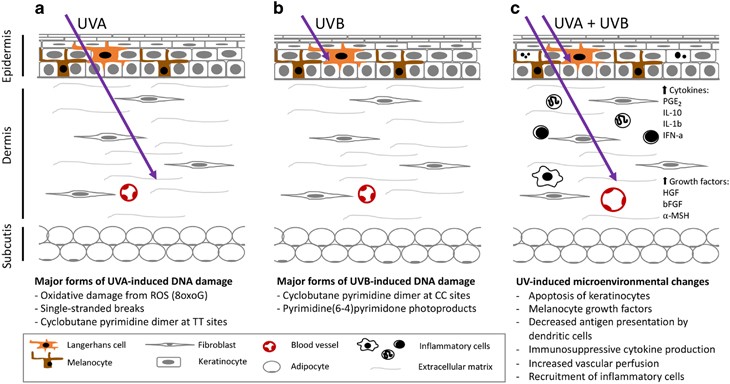 Mouse Models Of Uv Induced Melanoma Genetics Pathology And Clinical Relevance Laboratory Investigation
