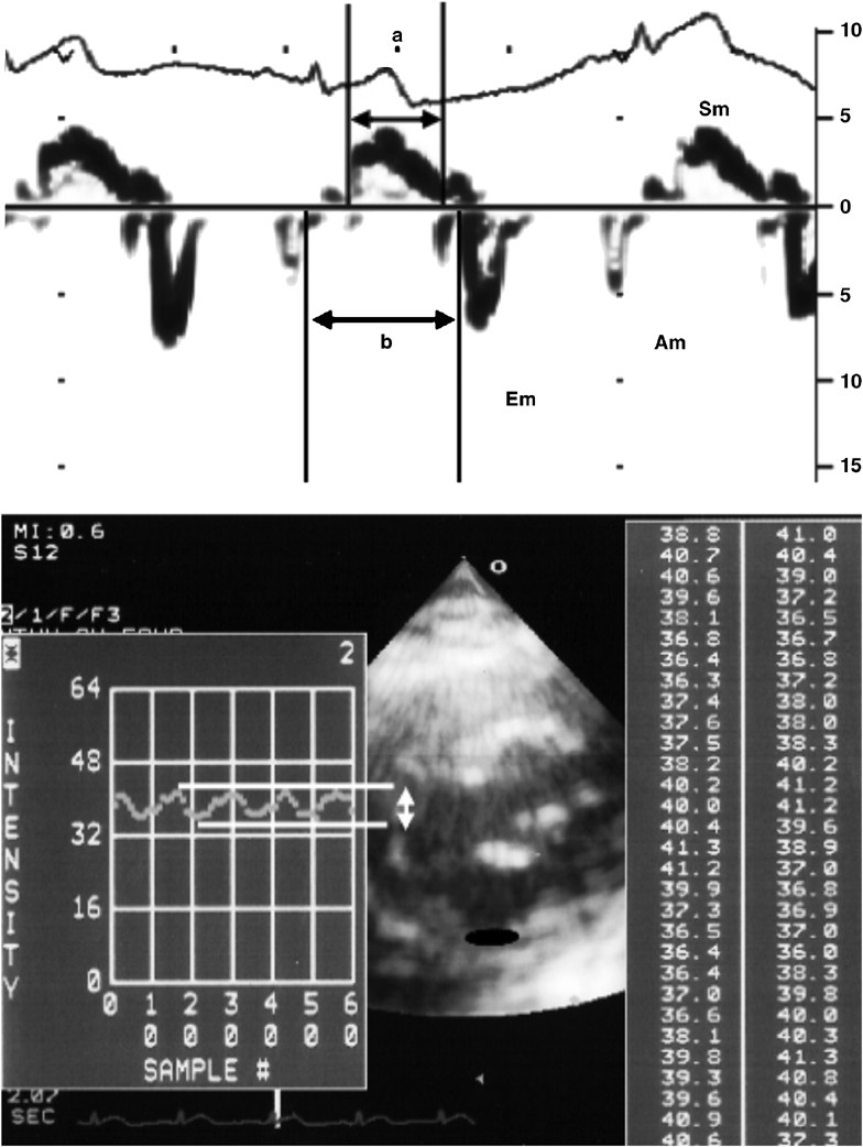 connexin and 43 suppressed ... myocardial Downregulated