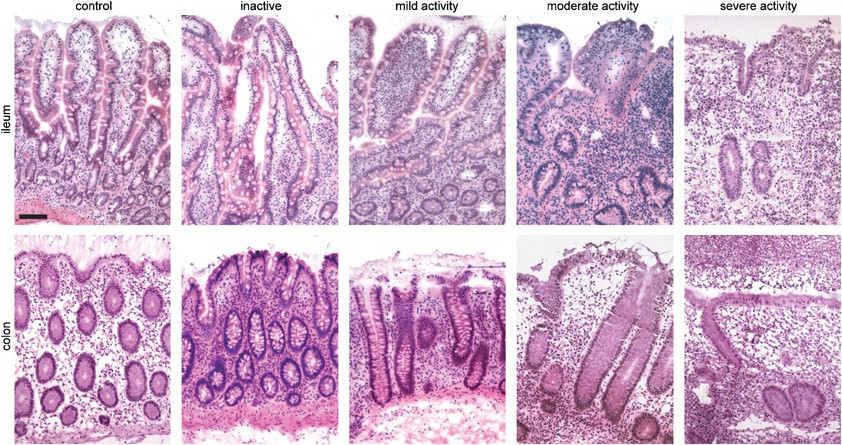 Epithelial myosin light chain kinase expression and activity are  upregulated in inflammatory bowel disease | Laboratory Investigation