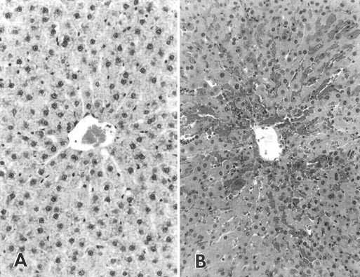 glutathione peroxidase activity in selenium deficient rat liver The Selenoprotein 4: From Molecular Mechanisms to Novel Therapeutic Opportunities Rapid and effective protocol to