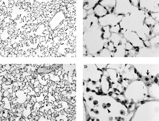 Analysis of the Lung Pathology and Alveolar Macrophage Function in the Acid  Sphingomyelinase–Deficient Mouse Model of Niemann-Pick Disease | Laboratory  Investigation
