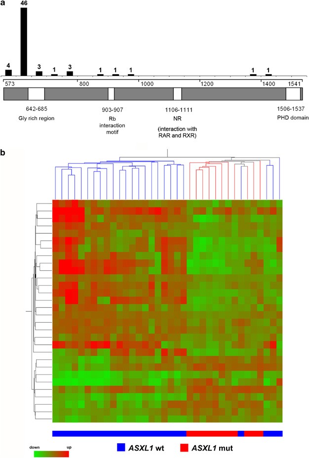 Frequent Mutation Of The Polycomb Associated Gene Asxl1 In The Myelodysplastic Syndromes And In Acute Myeloid Leukemia Leukemia Frequent Mutation Of The Polycomb Associated Gene Asxl1 In The Myelodysplastic Syndromes And In Acute Myeloid Leukemia Leukemia