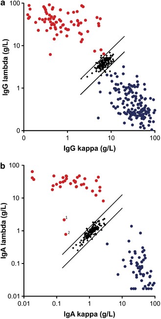 Prognostic utility of intact immunoglobulin Ig′κ/Ig′λ ratios in multiple  myeloma patients | Leukemia