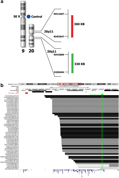 Detecting Dic 9 P13 2 P11 2 Positive B Cell Precursor Acute Lymphoblastic Leukemia In A Clinical Setting Using Fluorescence In Situ Hybridization Leukemia