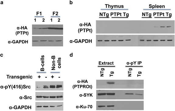 PTPROt-mediated regulation of p53/Foxm1 suppresses leukemic phenotype in a  CLL mouse model | Leukemia