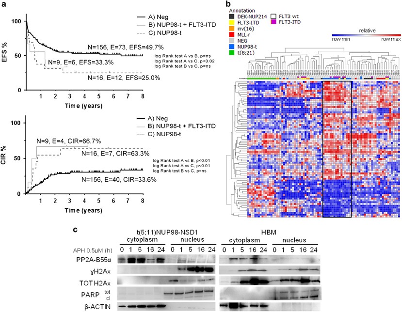 Nup98 Fusion Transcripts Characterize Different Biological Entities Within Acute Myeloid Leukemia A Report From The Aieop Aml Group Leukemia