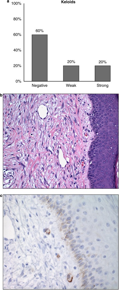 Prostate-specific membrane antigen expression in regeneration and repair |  Modern Pathology