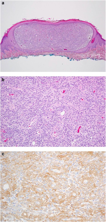 Label the photomicrograph of thick skin