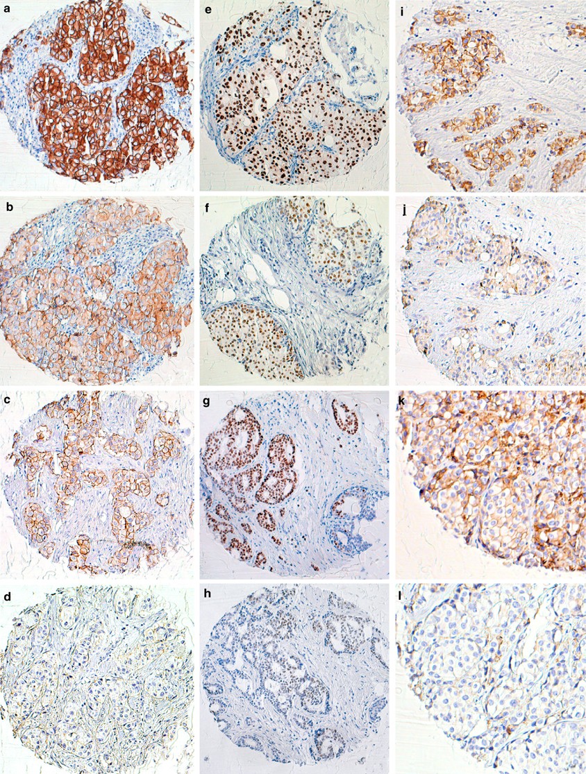 Influence of slide aging on results of translational research studies using  immunohistochemistry | Modern Pathology