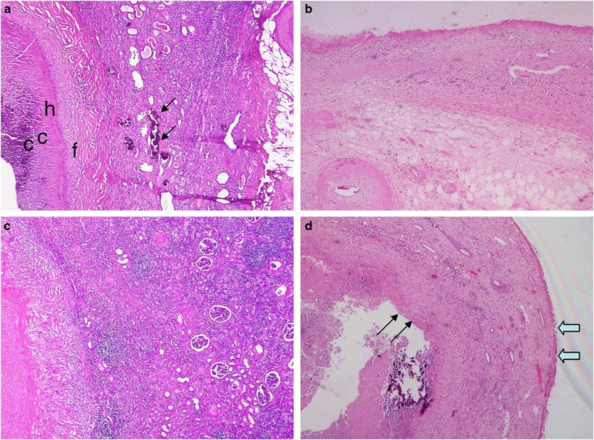 flank pain - Hum NEWS